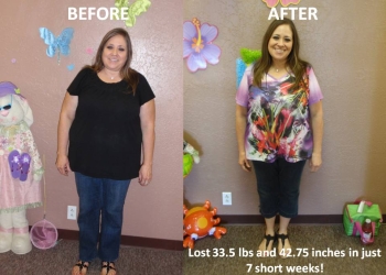 A woman is before and after her weight loss.