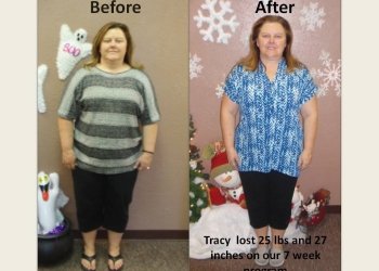 A woman is before and after her weight loss.