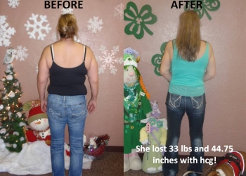 A woman is before and after her weight loss.